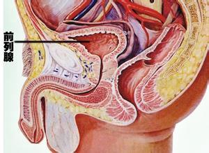 慢性前列腺炎的癥狀及其影響，慢性前列腺炎的癥狀及影響概述