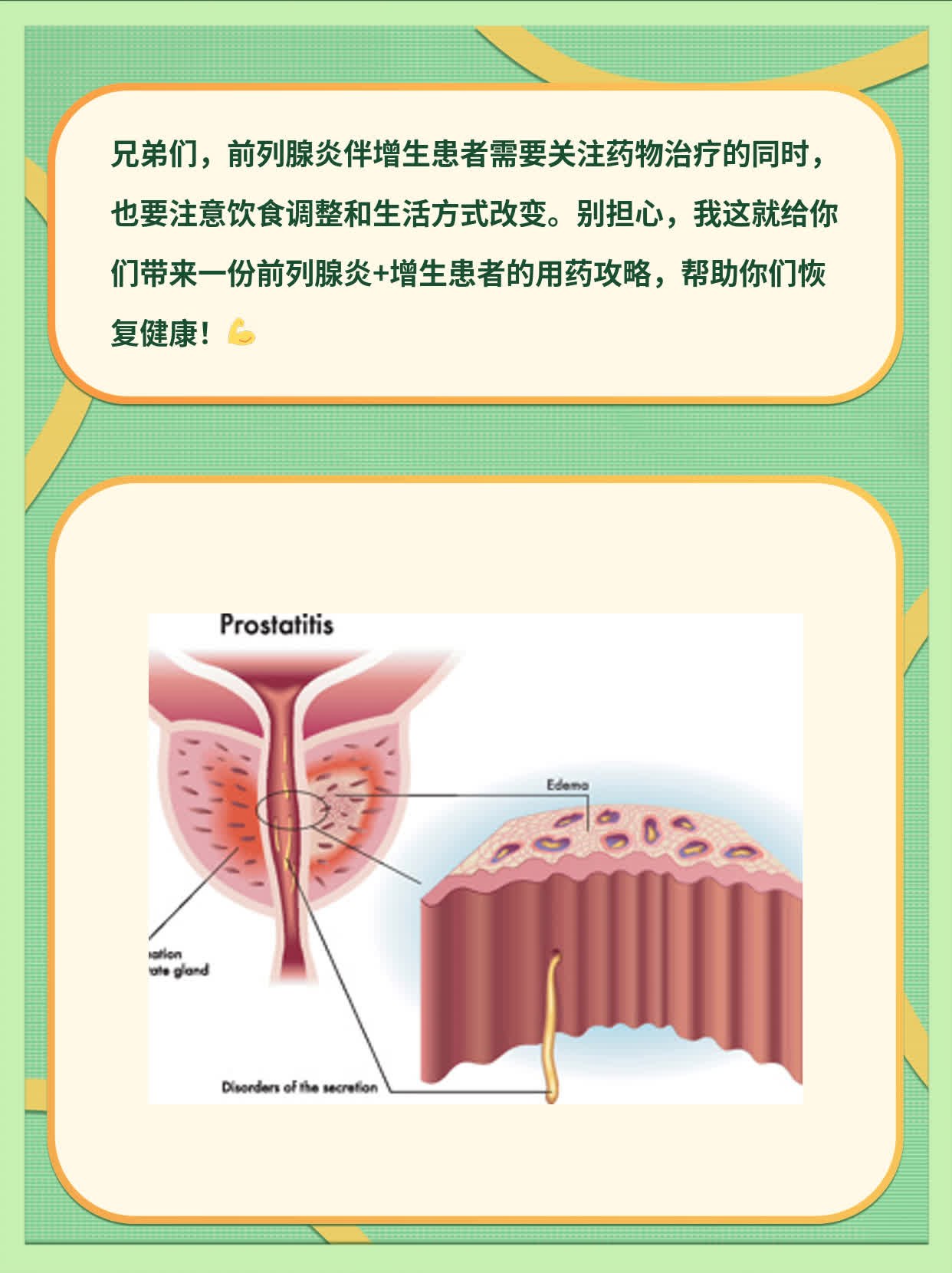 前列腺增生藥物治療指南，了解藥物治療與選擇，前列腺增生藥物治療詳解，指南與選擇